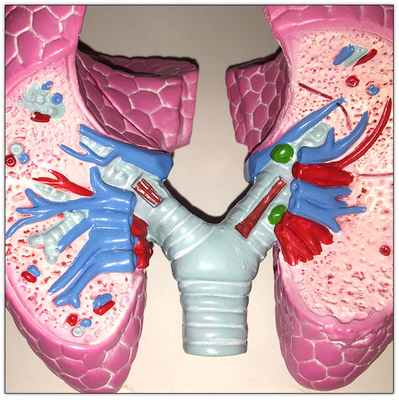 플라스틱 COPD 폐 인체 기관 모형 내장 학습 19x13x17cm